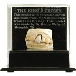 Elvis Presley's Dental Crown With Model of Teeth