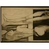 Image 4 : ERNST FUCHS Aquatint Etching Austrian