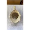 Image 10 : JUG AND BOWL SET