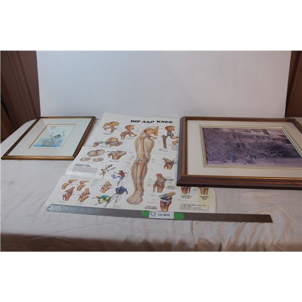 Framed art, Hip and knee poster