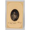 Image 1 : Civil War CDV Tintype Photo Orphan Boy