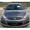 Image 3 : 2017 HYUNDAI ACCENT - 88168KM