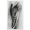 Image 1 : Man Ray - "Mani Solarizzate" Photograph