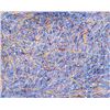 Image 1 : American Acrylic on Canvas Signed Jackson Pollock