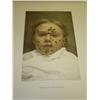 Image 3 : Photographic Atlas. Diseases of the Skin