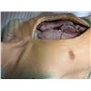 Image 2 : Open heart surgery wearable silicone chest piece