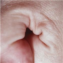 Jeanne  Dunning Untitled Hole 