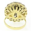 Image 5 : Handmade 18k Yellow and White Gold Akoya Pearl Cocktail Ring