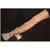 Image 1 : LEG CUT OPEN FOR SURGERY