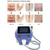 Image 2 : NEW MAGIC PLUS VERTICAL HAIR REMOVAL MACHINE $2399