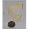 Image 1 : Teeth casting