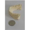 Image 2 : Teeth casting