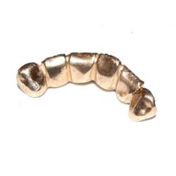 18K Gold Teeth 12.9g