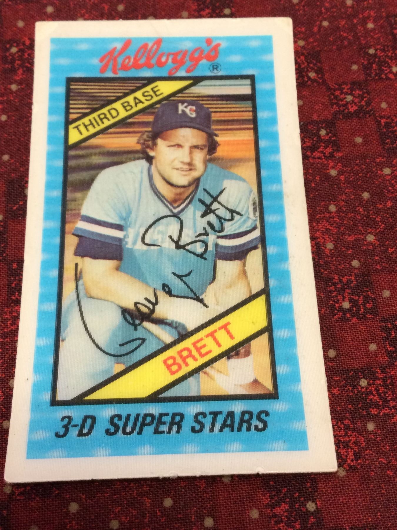 Scarce George Brett baseball card, highlighting the allure of rare and overlooked vintage issues.