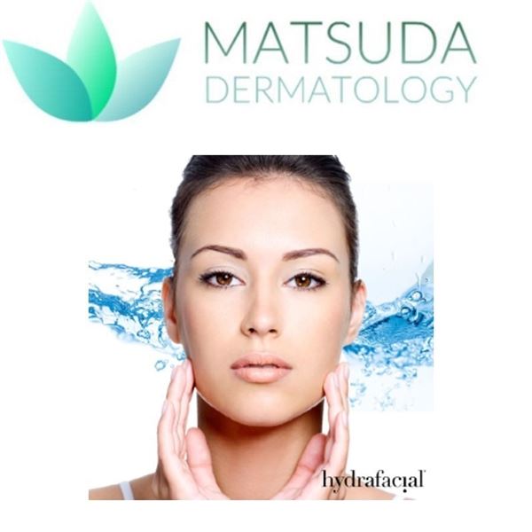 Hydrafacial MD Single Treatment at Matsuda Dermatology