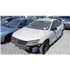 Image 1 : 2014 Volkswagen Jetta S