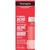 NEW NEUTROGENA STUBBORN ACNE DRYING LOTION