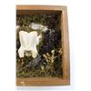 Image 5 : Framed Animal Bone Art - Cow Cervical Vertebra- 11" x 8"