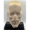 Image 2 : "Debris" - Face transplant piece (skin and face)