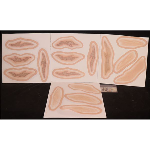 SCARS GOUGES FRACTURES AND BURNS LOT OF 16