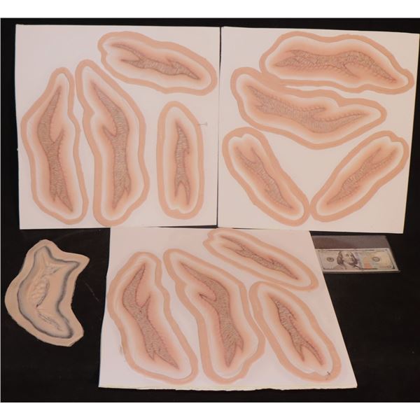 SCARS GOUGES FRACTURES AND BURNS LOT OF 13