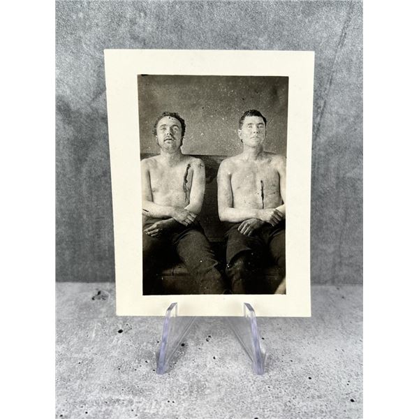 James Younger Gang Members Death Photo