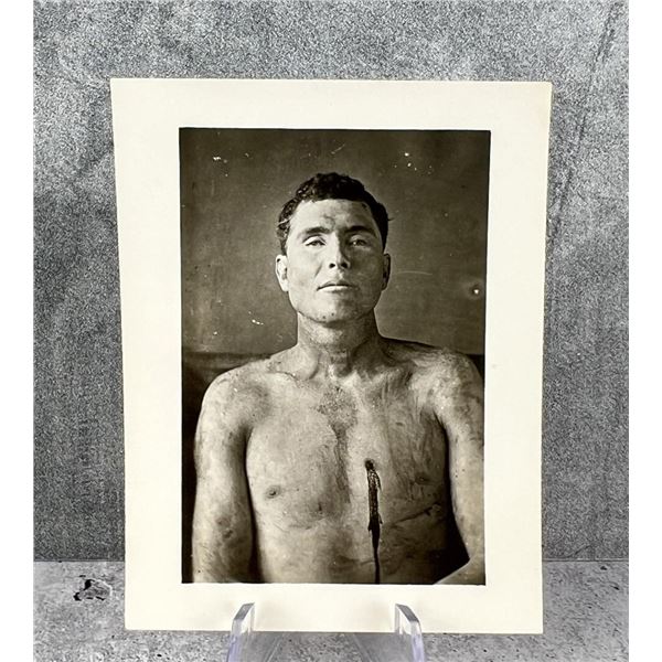 James Younger Gang Member Bill Stiles Death Photo