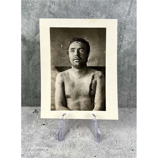 James Younger Gang Member Clell Miller Death Photo