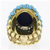 Image 7 : Vintage 14k Gold Cabochon Lapis Turquoise Bead & Diamond Textured Cocktail Ring