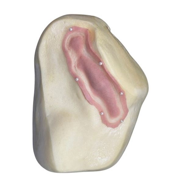 Incoming Koosh's (Bardia Seiri) Hero SFX Broken Bone Appliance