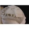 Image 3 : Antique Juliet Wedding Cap & Delicate Handkerchief Set