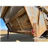 Image 9 : 2004 MIDLAND MX3000 TRIDEM BOTTOM DUMP TRAILER