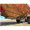 Image 12 : 2000 ADVANCE SUPER B-TRAIN GRAIN TRAILERS