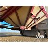 Image 25 : 2000 LOADKING SUPER B-TRAIN GRAIN TRAILERS