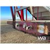 Image 6 : 2000 LOADKING SUPER B-TRAIN GRAIN TRAILERS
