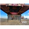 Image 8 : 2000 LOADKING SUPER B-TRAIN GRAIN TRAILERS