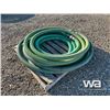 Image 4 : 2' HOSES