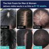 Image 4 : SUNHEAL 60G 5% MINOXIDIL HAIR GROWTH KIT