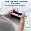 Image 3 : 1 CheckMe BP2 Wireless Blood Pressure Monitor with Bluetooth/App ECG Analysis Function - New Sealed