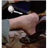 Image 7 : Pet Sematary (1989) - Jud (Fred Gwynne) Leg With Custom Made Display