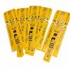 Image 1 : Armstrong Medical Geen Speed Splint X 5 Qty