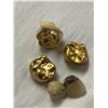 Image 1 : Teeth In Gold & Silver