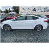 Image 21 : 0C -- 2017 HYUNDAI ELANTRA, WHITE, 159362 KMS, FRONT WHEEL DRIVE "NO RESERVE" "REPO UNIT"