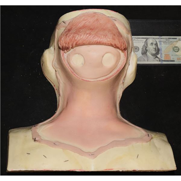 NO RESERVE BRAIN SURGERY SILICONE APPLIANCE COWL ON FORM