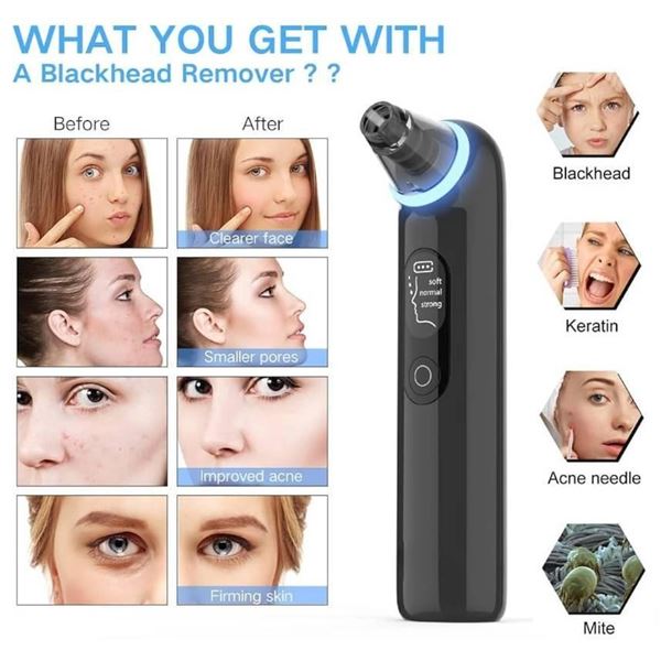 Blackhead Remover Device With Blue Light and Specifications