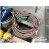 Image 3 : OXY ACETYLENE HOSE & REGULATOR KIT