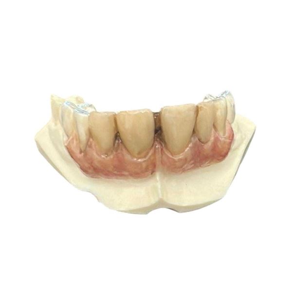 Mortdecai (2015) - Mortdecai (Johnny Depp) Teeth Appliance On Dental Cast