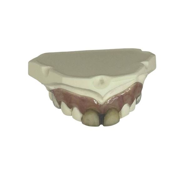 Alice in Wonderland (2010) - The Mad Hatter (Johnny Depp) Teeth Appliance