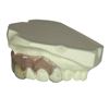 Image 3 : Alice in Wonderland (2010) - The Mad Hatter (Johnny Depp) Teeth Appliance