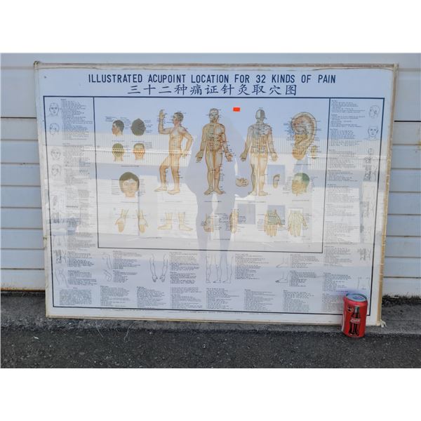 Acupuncture Diagram Poster